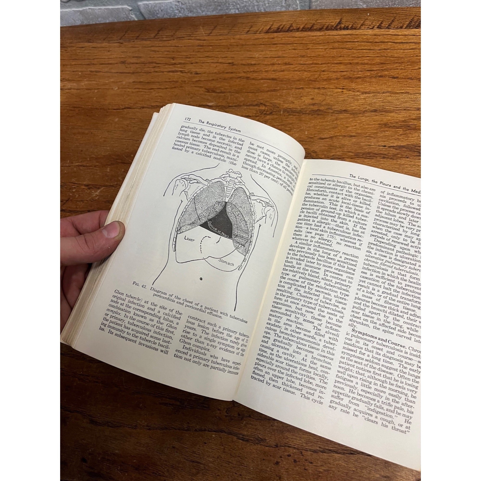 Vintage 1950 Essentials Of Medicine Basics Of Nursing Care Hardcover Book